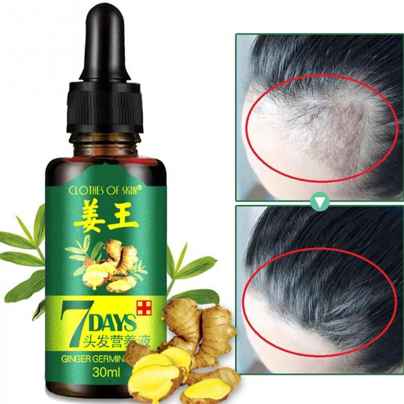 Hot Sale Unisex Anti Hair Loss Treatment Serum Ginger Extract Hair Regrowth Organic Beard Oil Growing Men Women Hair Care